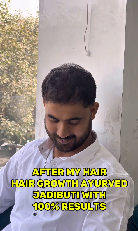 Instagram Gallery Image