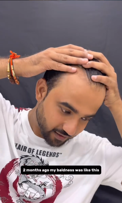 Instagram Gallery Image